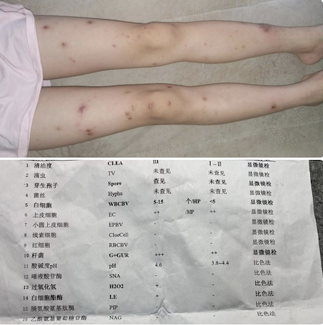 kk园区四合院的金蚂蚁一个代理，代号夏天-白菜网论坛-白菜社区